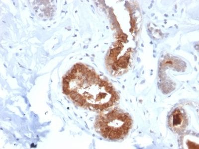 Mammaglobin Recombinant Monoclonal Rabbit Antibody (MGB1/2123R)