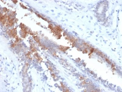 Mammaglobin Recombinant Monoclonal Rabbit Antibody (MGB1/2123R)