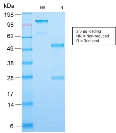 Mammaglobin Recombinant Monoclonal Rabbit Antibody (MGB1/2123R)