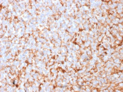 Mammaglobin Recombinant Monoclonal Rabbit Antibody (MGB1/2682R)