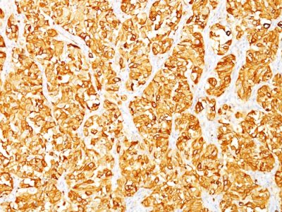 MART-1 / Melan-A / MLANA Monoclonal Mouse Antibody (DT101 + BC199)