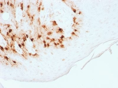 MART-1 / Melan-A / MLANA Recombinant Monoclonal Rabbit Antibody (MLANA/1761R)