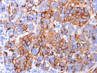 MART-1 / Melan-A Monoclonal Mouse Antibody (A103)