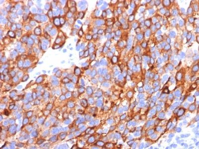 MART-1 / Melan-A Monoclonal Mouse Antibody (M2-7C10 + M2-9E3 + A103)