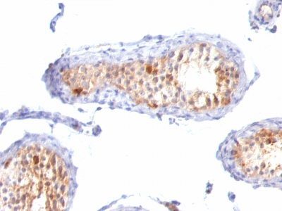 MART-1 / Melan-A Monoclonal Mouse Antibody (M2-7C10 + M2-9E3 + A103)