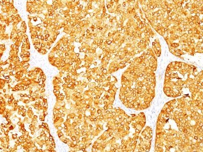 MART-1 / Melan-A Monoclonal Mouse Antibody (M2-7C10 + M2-9E3)