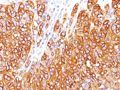 MART-1 / Melan-A Monoclonal Mouse Antibody (M2-7C10)