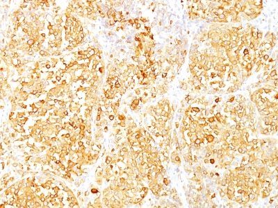 MART-1 / Melan-A Monoclonal Mouse Antibody (M2-9E3)