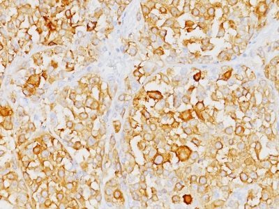 MART-1 / Melan-A Monoclonal Mouse Antibody (M2-9E3)