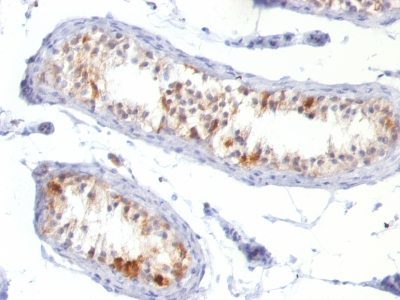 MART-1 / Melan-A Monoclonal Mouse Antibody (MLANA/788)