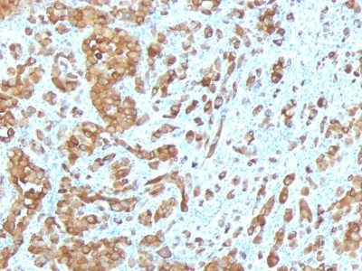 MART-1 / Melan-A Monoclonal Mouse Antibody (MLANA/788)