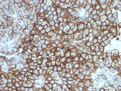 Melanoma Marker Monoclonal Mouse Antibody (KBA.62)