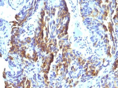 Melanoma Marker Monoclonal Mouse Antibody (KBA.62)