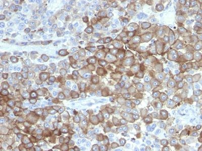 Melanoma Marker Monoclonal Mouse Antibody (PNL2)