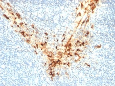 Mesothelin Monoclonal Mouse Antibody (MSLN/2131)