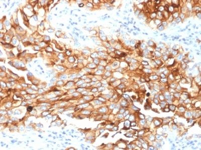Mesothelin Monoclonal Mouse Antibody (MSLN/2131)