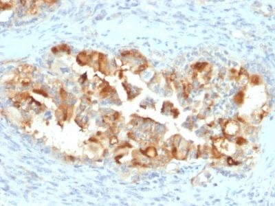 Mesothelin Monoclonal Mouse Antibody (MSLN/2131)