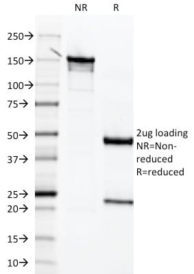 Mesothelin Monoclonal Mouse Antibody (MSLN/2131)