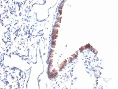 Mesothelin Monoclonal Mouse Antibody (MSLN/2131)