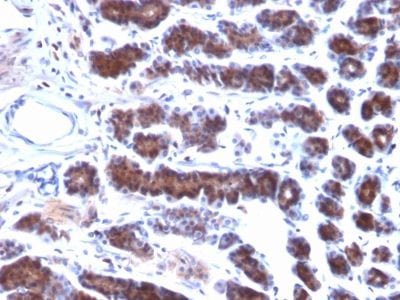 Mesothelin Monoclonal Mouse Antibody (MSLN/2131)
