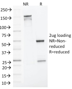 MLH1 Monoclonal Mouse Antibody (MLH1/1324)