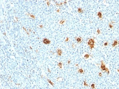 MRP-14 Monoclonal Mouse Antibody (MRP14/840)