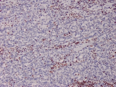 MSH2 Monoclonal Mouse Antibody (MSH2/2622)