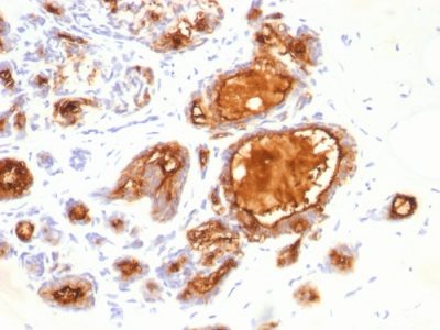 Mucin 1 / EMA / Episialin / CD227 Monoclonal Mouse Antibody (115D8)