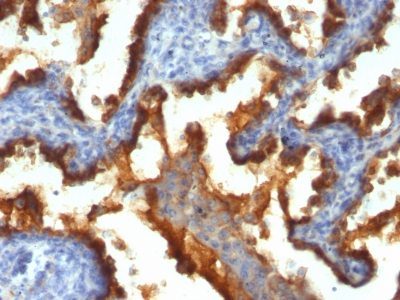 Mucin 1 / EMA / Episialin / CD227 Monoclonal Mouse Antibody (139H2)