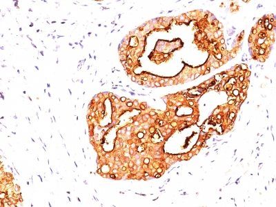 Mucin 1 / EMA / Episialin / CD227 Monoclonal Mouse Antibody (139H2)