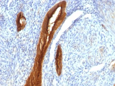 Mucin 1 / EMA / Episialin / CD227 Monoclonal Mouse Antibody (139H2)