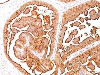 Mucin 1 / EMA / Episialin / CD227 Monoclonal Mouse Antibody (E29)