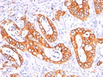 Mucin 1 / EMA / Episialin / CD227 Monoclonal Mouse Antibody (GP1.4 + E29)