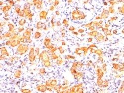 Mucin 1 / EMA / Episialin / CD227 Monoclonal Mouse Antibody (GP1.4)