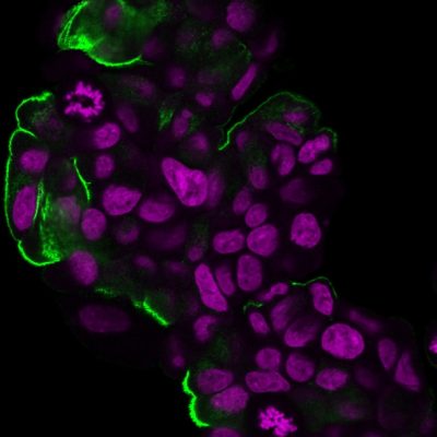 Mucin 1 / EMA / Episialin / CD227 Monoclonal Mouse Antibody (HMPV)