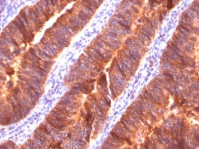 Mucin 1 / EMA / Episialin / CD227 Monoclonal Mouse Antibody (MUC1/520)