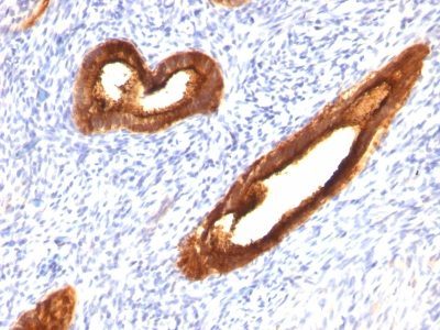 Mucin 1 / EMA / Episialin / CD227 Monoclonal Mouse Antibody (MUC1/520)