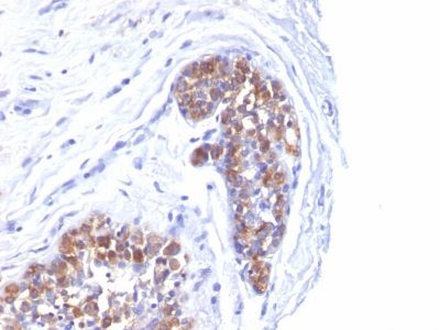 Mucin 1 / EMA / Episialin / CD227 Monoclonal Mouse Antibody (MUC1/520)