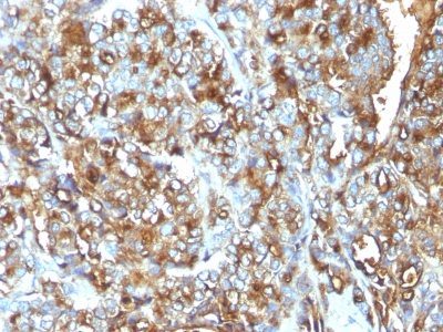 Mucin 1 / EMA / Episialin / CD227 Monoclonal Mouse Antibody (MUC1/520)