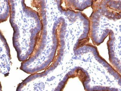 Mucin 1 / EMA / Episialin / CD227 Monoclonal Mouse Antibody (MUC1/845)