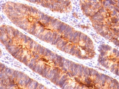 Mucin 1 / EMA / Episialin / CD227 Monoclonal Mouse Antibody (MUC1/845)