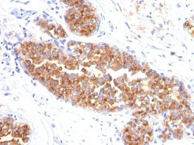 Mucin 1 / EMA / Episialin / CD227 Monoclonal Mouse Antibody (MUC1/845)