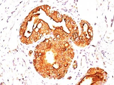 Mucin 1 / EMA / Episialin / CD227 Monoclonal Mouse Antibody (MUC1/845)