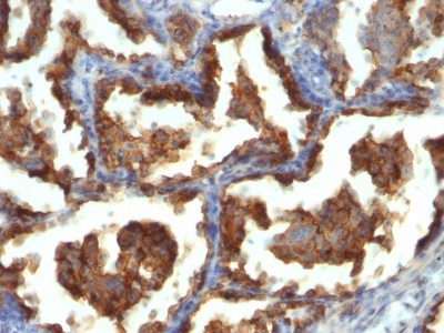 Mucin 1 / EMA / Episialin / CD227 Monoclonal Mouse Antibody (MUC1/955)