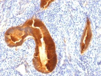 Mucin 1 / EMA / Episialin / CD227 Monoclonal Mouse Antibody (MUC1/955)