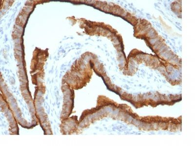 Mucin 1 / EMA / Episialin / CD227 Monoclonal Mouse Antibody (MUC1/967)