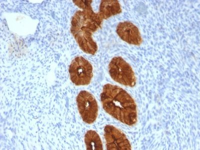 Mucin 1 / EMA / Episialin / CD227 Monoclonal Mouse Antibody (MUC1/967)