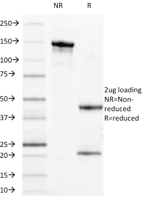 Mucin 1 / EMA / Episialin / CD227 Monoclonal Mouse Antibody (VU-11D1)