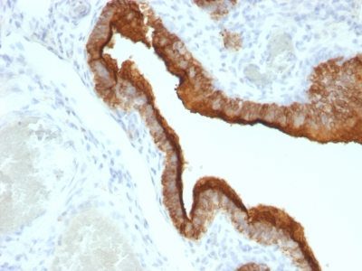 Mucin 1 / EMA / Episialin / CD227 Monoclonal Mouse Antibody (VU-2G7)