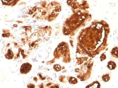 Mucin 1 / EMA / Episialin / CD227 Recombinant Monoclonal Mouse Antibody (rMUC1/960)